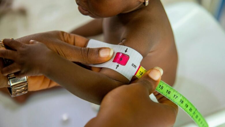 UNICEF Report Warns of Alarming Malnutrition Crisis Among Infants in Eastern, Southern Africa