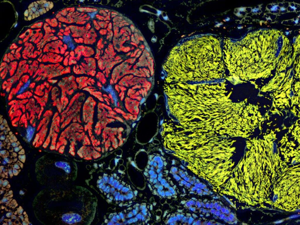 Microbe With the Smallest Genome Ever Discovered Blurs the Line Between Bacteria and Organelles