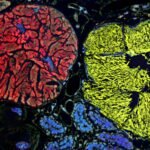 Microbe With the Smallest Genome Ever Discovered Blurs the Line Between Bacteria and Organelles