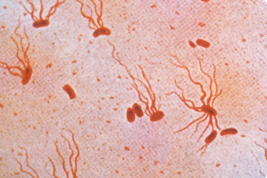 Ancient Typhoid Bacterium Rapidly Gaining Drug Resistance, Scientists Warn