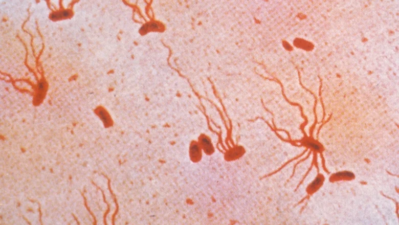 Ancient Typhoid Bacterium Rapidly Gaining Drug Resistance, Scientists Warn