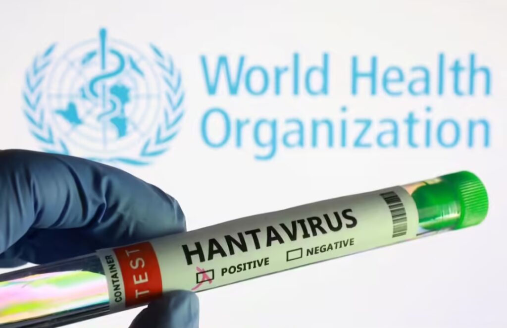Hantavirus: The Silent Virus Raising Global Health Concerns