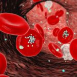 Microplastics Detected More Frequently in Heart Attack Patients Study Finds